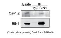 BIN1 antibody western blot Sigma-Aldrich