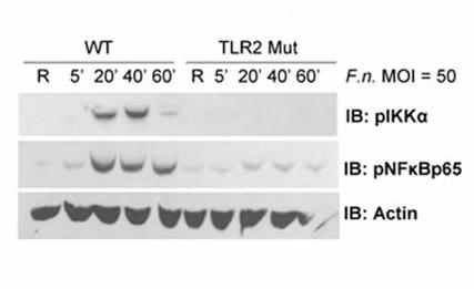 IKK alpha antibody western blot Cell Signaling Technology