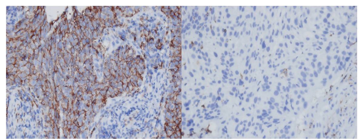HLA-DQB1 antibody immunohistochemistry Leica Microsystems
