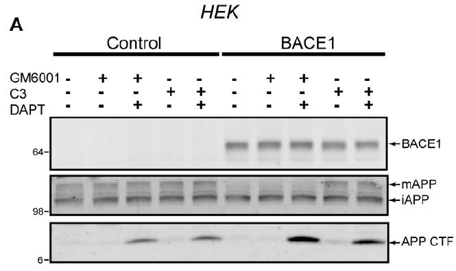 APP antibody western blot EMD Millipore