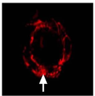 beta actin antibody immunohistochemistry Dako