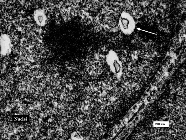 Evidencia directa de infección viral y alteraciones mitocondriales en el cerebro de fetos de madres esquizofrénicas en alto riesgo de esquizofrenia Figura 1