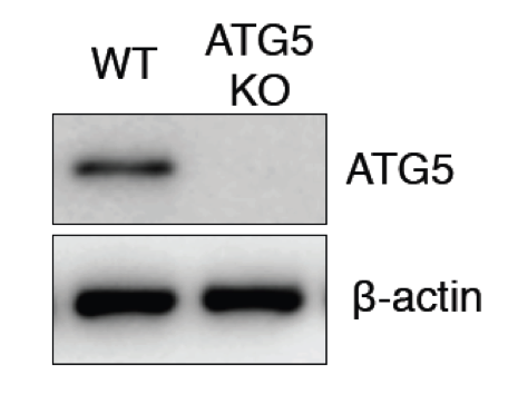 Cell Signaling Technology rabbit monoclonal antibody 8540 was validated in knockout cell line figure 1