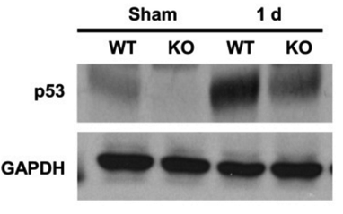 P53 antibody | knockout validation | Cell Signaling 2524 figure 5