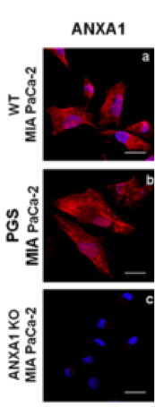 annexin A1 antibody | knockout validation | Invitrogen 71–3400 figure 2