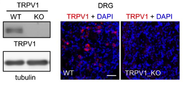 TRPV1 antibody | knockout examination | Santa Cruz Biotechnology sc-12498 figure 1