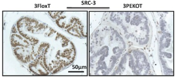 SRC-3 antibody | knockout validation | Cell Signaling 2126 figure 1
