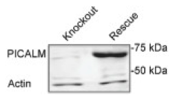 PICALM antibody | knockout validation | Sigma-Aldrich HPA019061 figure 1