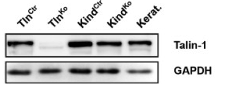 talin-1 antibody | knockout validation | Abcam ab57758 figure 1