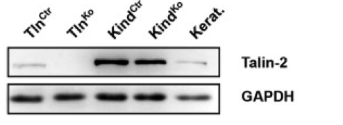 talin-2 antibody | knockout validation | Abcam ab105458 figure 1