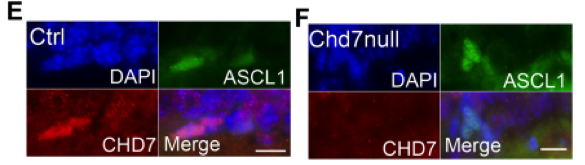 CHD7 antibody | knockout validation | Abcam ab31824 figure 2