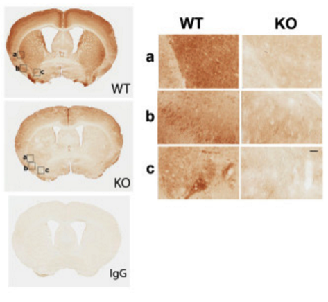 LRRK2 antibody | knockout validation | Epitomics MJFF2 figure 2