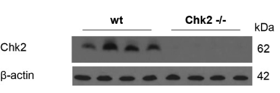 Chk2 antibody | knockout validation | Cell Signaling Technology 3440 figure 1