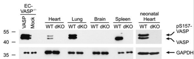 VASP antibody | knockout validation | Immunoglobe IG-731 figure 1