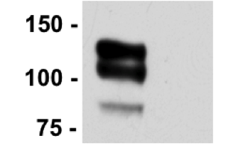LRP8 antibody | knockout validation | Abcam ab108208 figure 1