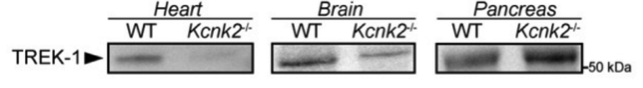 TREK-1 antibody | knockout validation | Santa Cruz Biotechnology sc-11554 figure 1