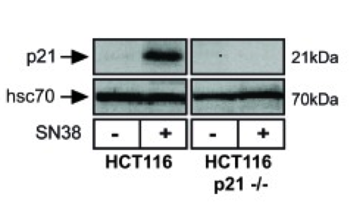 p21 antibody | knockout validation | Cell Signaling Technology 2947S figure 1