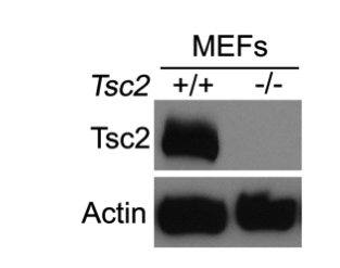 TSC2 antibody | knockout validation | Cell Signaling 4308 figure 1
