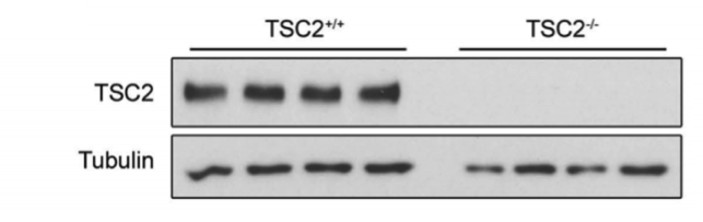 TSC2 antibody | knockout validation | Cell Signaling 4308 figure 2