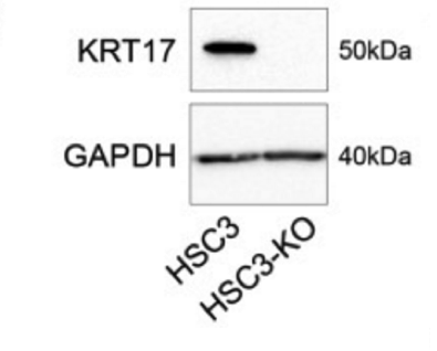 KRT17 antibody | knockout validation | Cell Signaling 4543 figure 1