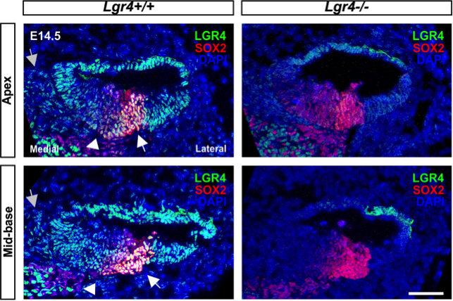 LGR4 antibody | knockout validation | Sigma HPA030267 figure 1