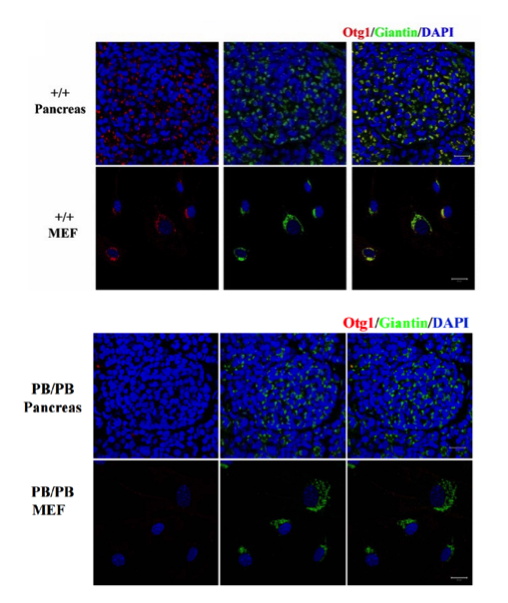OTG1 antibody | knockout validation | Sigma HPA018019 figure 2