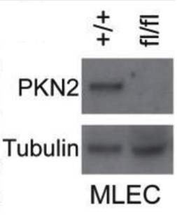 PKN2 antibody | knockout validation | Abcam ab119936 figure 1
