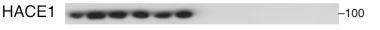 HACE1 antibody | knockout validation | Abcam ab133637 figure 1