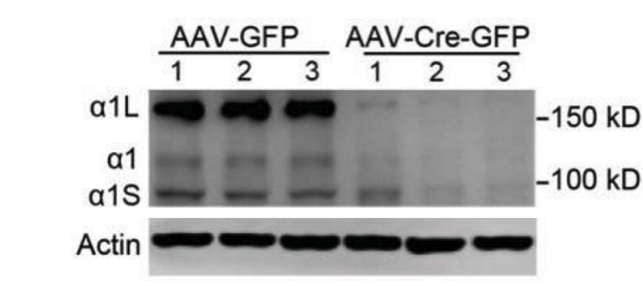 PGC-1 antibody | knockout validation | Millipore ST1202-1SET figure 1