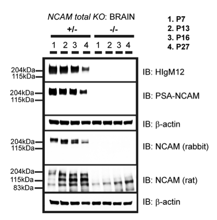 NCAM antibody | knockout validation | Millipore AB5032 figure 1