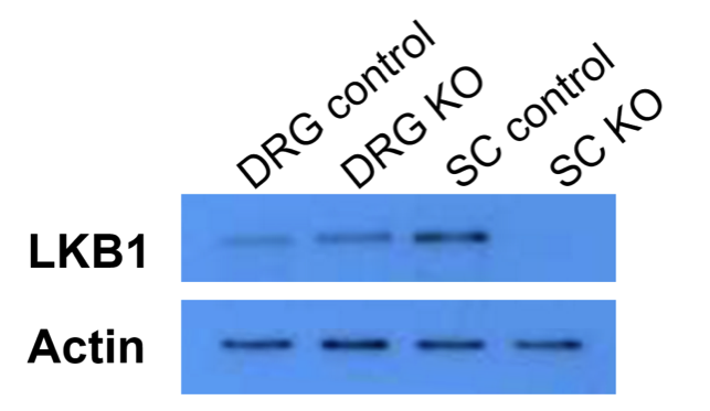 LKB1 antibody | knockout validation | Cell Signaling Technology 3047S figure 1