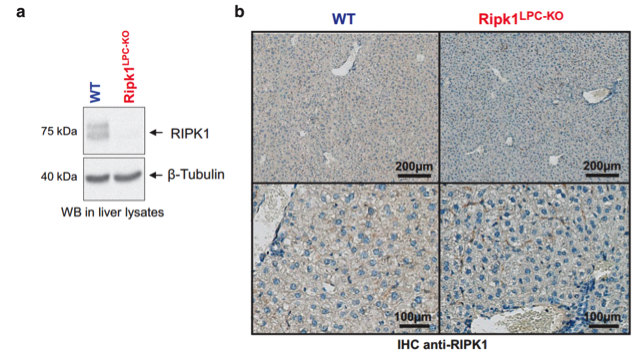 RIP antibody | knockout validation | Cell Signaling 3493 figure 1
