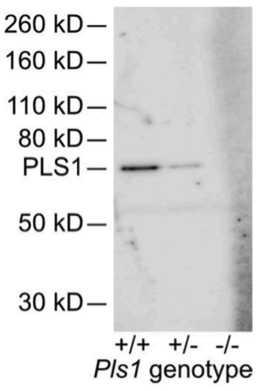 PLS1 antibody | knockout validation | Abnova H00005357-M04 figure 1