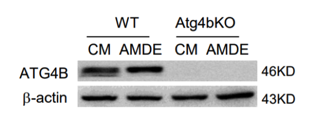 Atg4B antibody | knockout validation | MBL International M134-3 figure 1