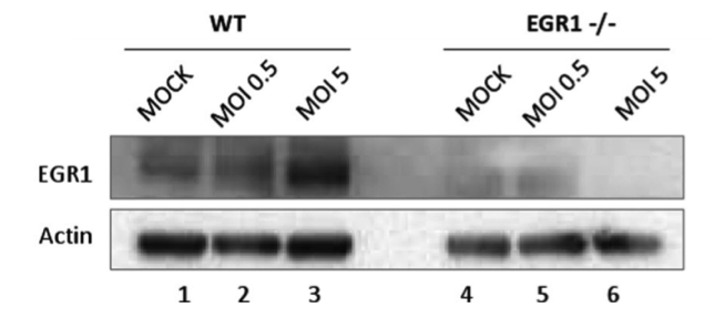 EGR1 antibody | knockout validation | Cell Signaling 4154 figure 1