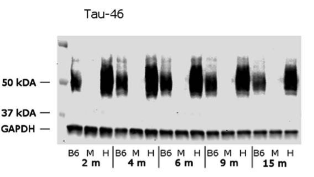 Tau antibody | knockout validation | Sigma Aldrich T9450 figure 1