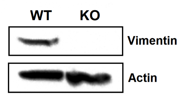 Vimentin antibody | knockout validation | Cell Signaling 5741 figure 1
