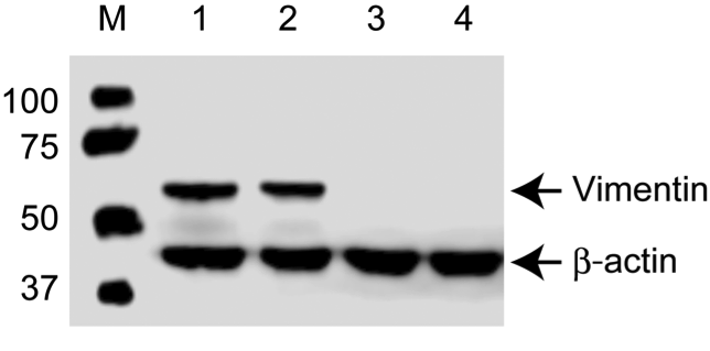 Vimentin antibody | knockout validation | Sigma V6630 figure 1
