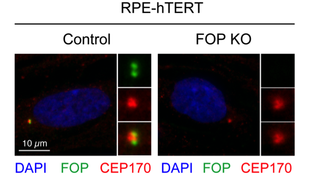 FGFR1OP antibody | knockout validation | Novus Biologicals H00011116-M01 figure 1