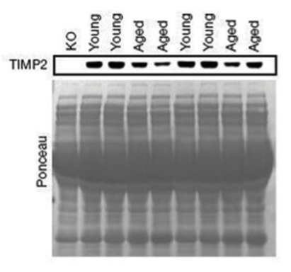 TIMP2 antibody | knockout validation | Cell Signaling 5738 figure 1