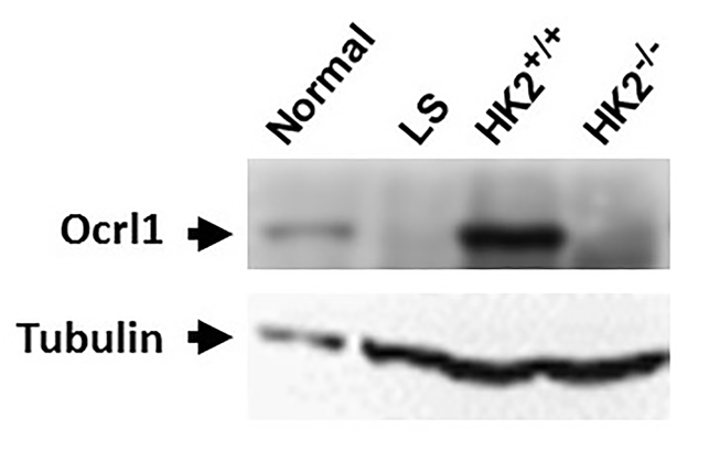 OCRL antibody | knockout validation | Santa Cruz sc-393577 figure 1