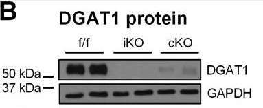 DGAT1 antibody | knockout validation | Santa Cruz sc-271934 figure 1