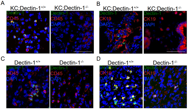 Dectin-1 antibody | knockout validation | Abcam ab53427 figure 1
