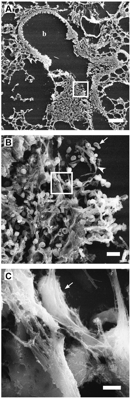 Extracellular Traps – NETosis and METosis figure 2