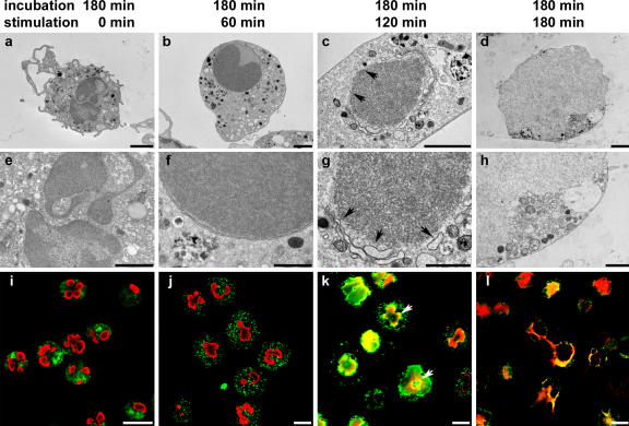Extracellular Traps – NETosis and METosis figure 3