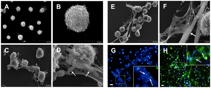 Extracellular Traps – NETosis and METosis figure 4
