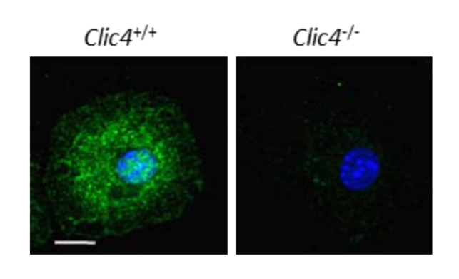 CLIC4 antibody | knockout validation | Santa Cruz sc-135739 figure 2