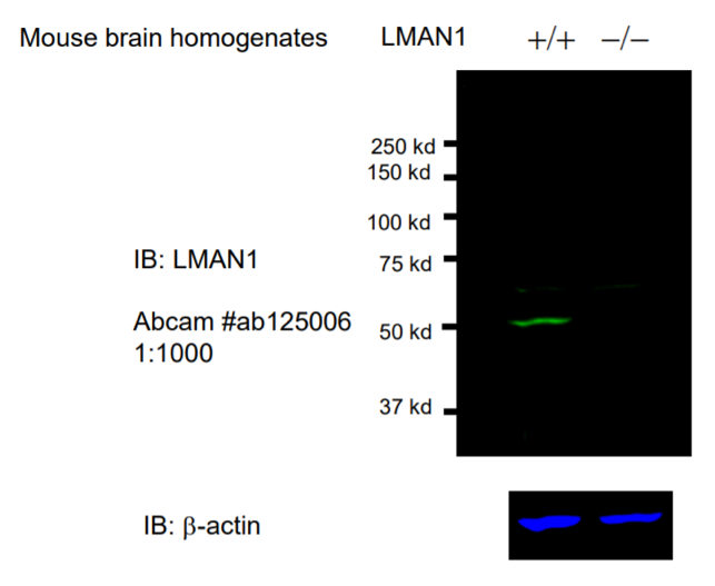 LMAN1 antibody | knockout validation | Abcam ab125006 figure 1