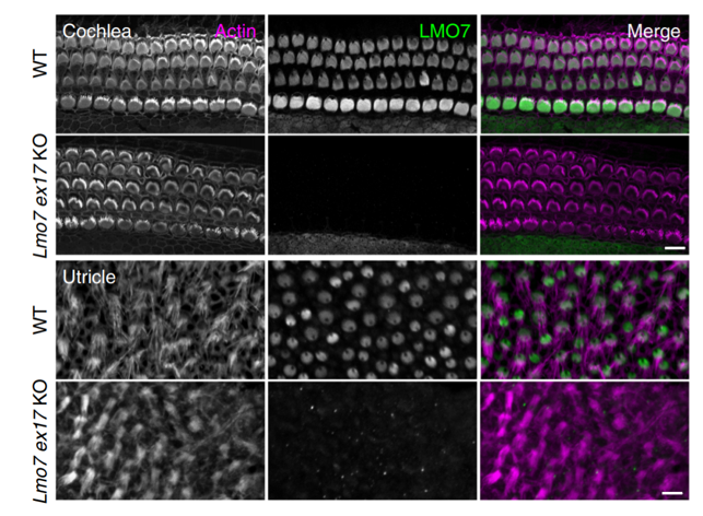 LMO7 antibody | knockout validation | Santa Cruz sc-376807 figure 1
