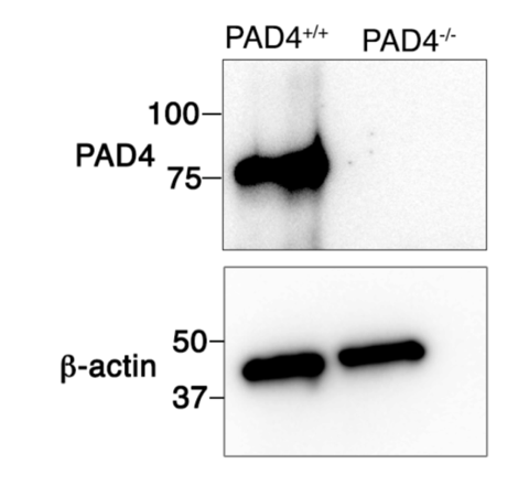 PADI4 / PAD4 antibody | knockout validation | Abcam ab214810 figure 1